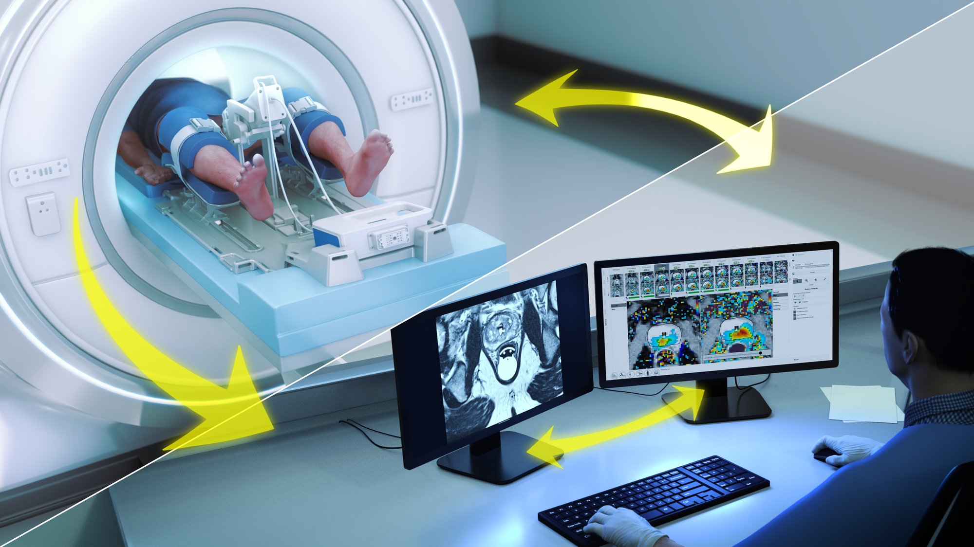 TULSA_Image_MRI-Screens TULSA_Image_MRI-Screens